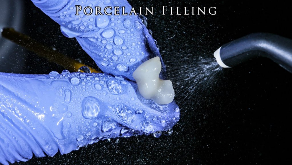 Porcelain Filling