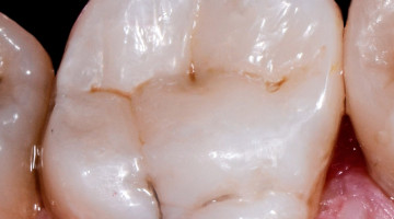 Kaizen With Dental Photography