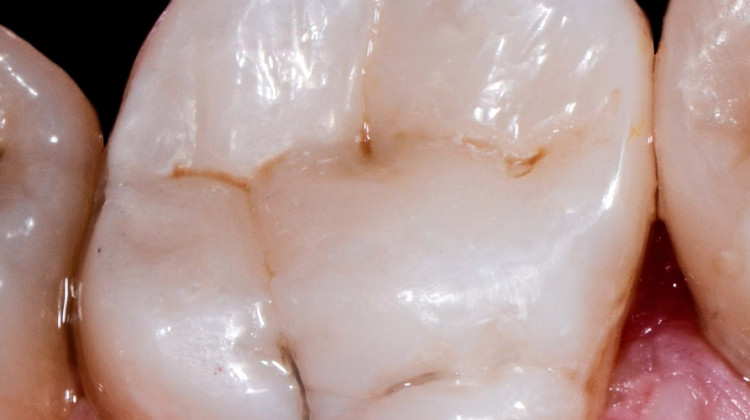 Kaizen With Dental Photography